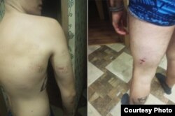 Олександр Д. Побої