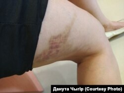 Пабоі пасьля таго, як міліцыя прыйшла ў аптэку да Дануты Чыгір