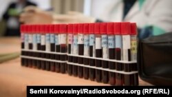 Після здачі крові її відправлять на станцію переливання. Там її перевірять, і після цього з неї зроблять препарати, які доставлять безпосередньо у лікарні