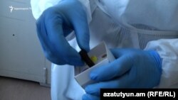 Կորոնավիրուսի թեստ՝ արտադրված Հայաստանում, արխիվ