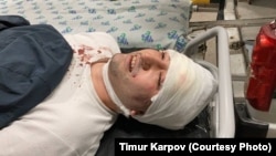Блогер Миразиз Базаров после избиения.